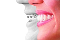 Orthodontics in Westlake, OH